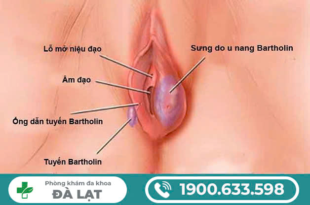 Hình ảnh minh họa
